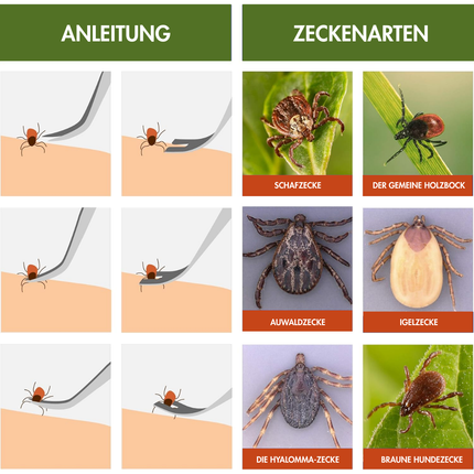 Zeckenzange 3er Set