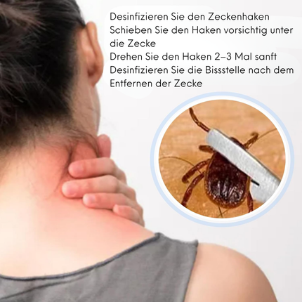 Edelstahl Zeckenzange