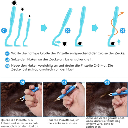 Zeckenentferner Set